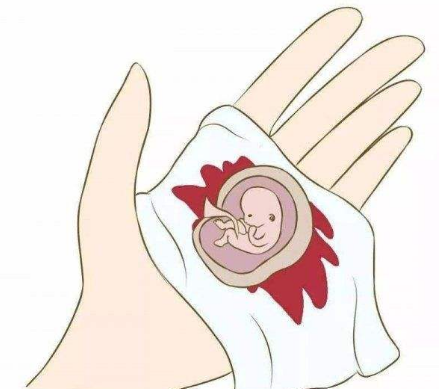 堕胎后遗症有哪些？ 