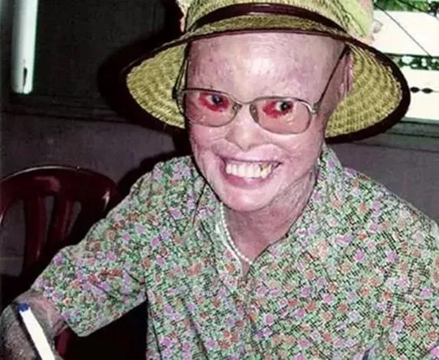 杀死穿山甲夫妻, 生出一个长着穿山甲身躯女儿（真实照片）