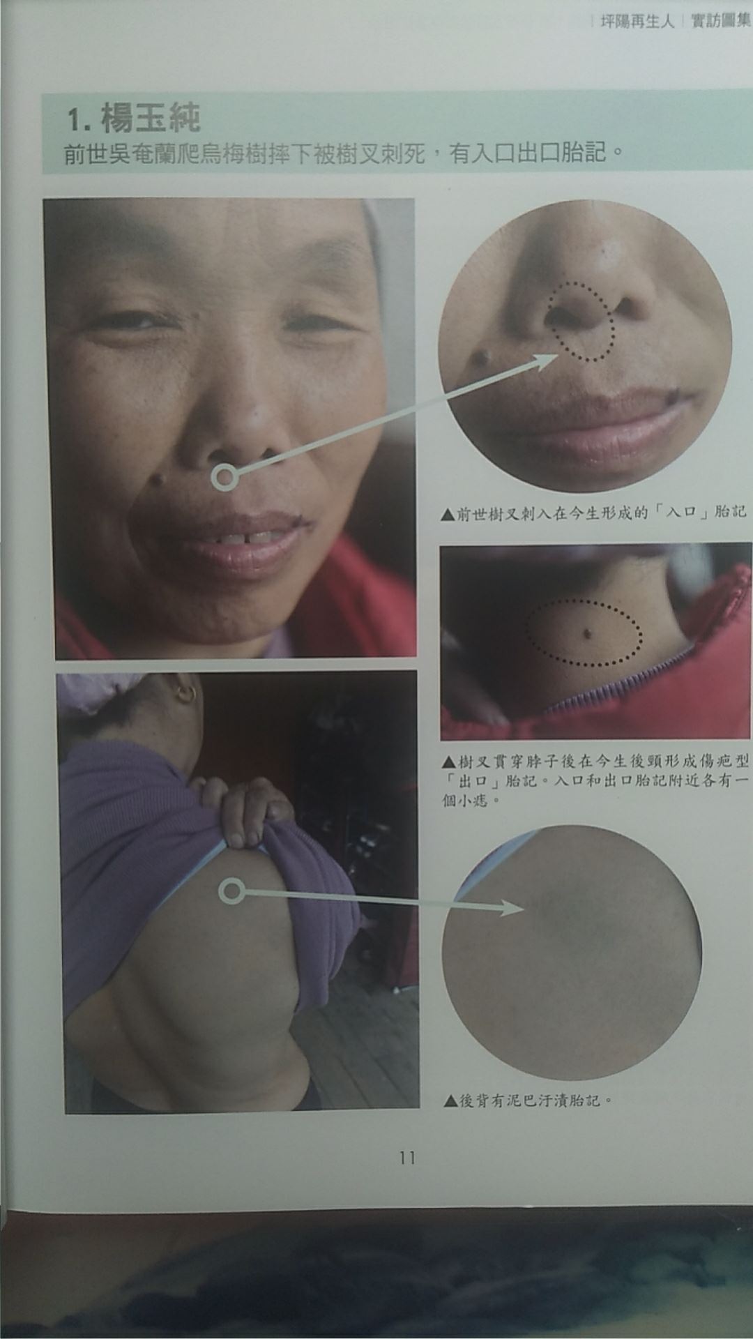 坪阳再生人案例1：杨玉纯，前世吴奄兰––爬乌梅树摔下被树叉刺死，有入口出口胎记