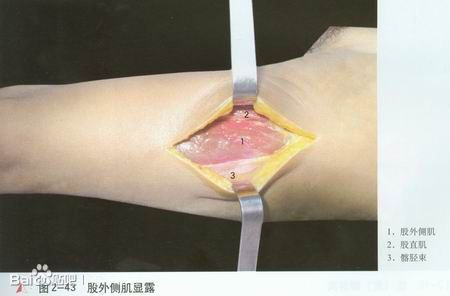 开素食餐厅，其功德不可估量