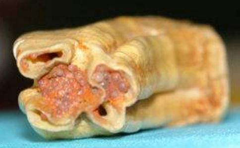 舍利子是什么？佛教的圣物舍利