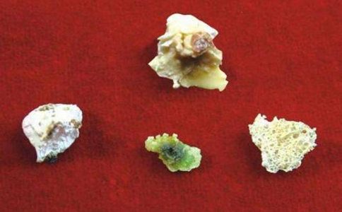 舍利花与舍利子怎么来的？有颜色的是舍利花吗？